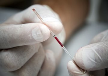 Autoridades de salud en Guaviare reportan 27 casos de VIH en el 2019